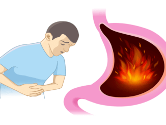 10 signs of gastroesophageal reflux disease