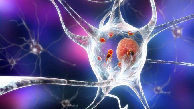 Parkinson's disease - causes, symptoms, treatment