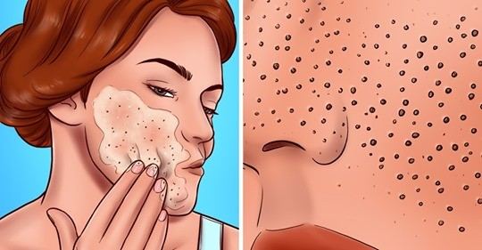 Skincare Mistakes